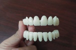Восстановите свою улыбку с помощью дентальной имплантации: испытайте мастерство в стоматологической клинике доктора Лопатина